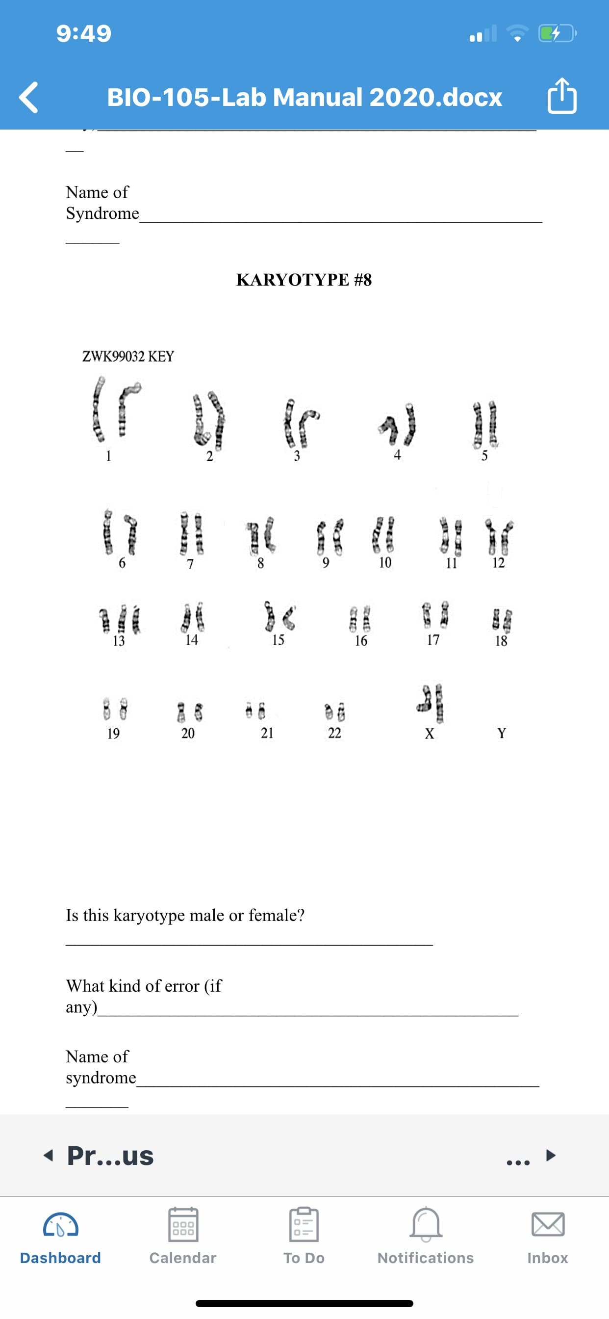 KARYOTYPE #8
ZWK99032 KEY
14
15
17
19
21
22
Y
Is this karyotype male or female?
What kind of error (if
any).
Name of
syndrome
9.
3.
20
OXEO
gerte
