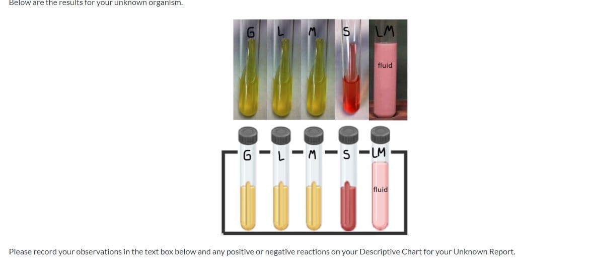 Below are the results for your unknown organism.
S
LM
fluid
6 -L-M - s -LM
fluid
Please record your observations in the text box below and any positive or negative reactions on your Descriptive Chart for your Unknown Report.
