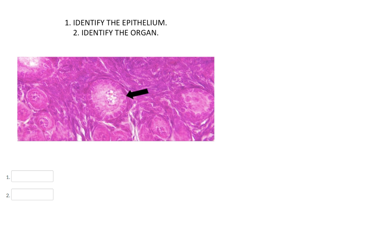 1. IDENTIFY THE EPITHELIUM.
2. IDENTIFY THE ORGAN.
1.
2.
