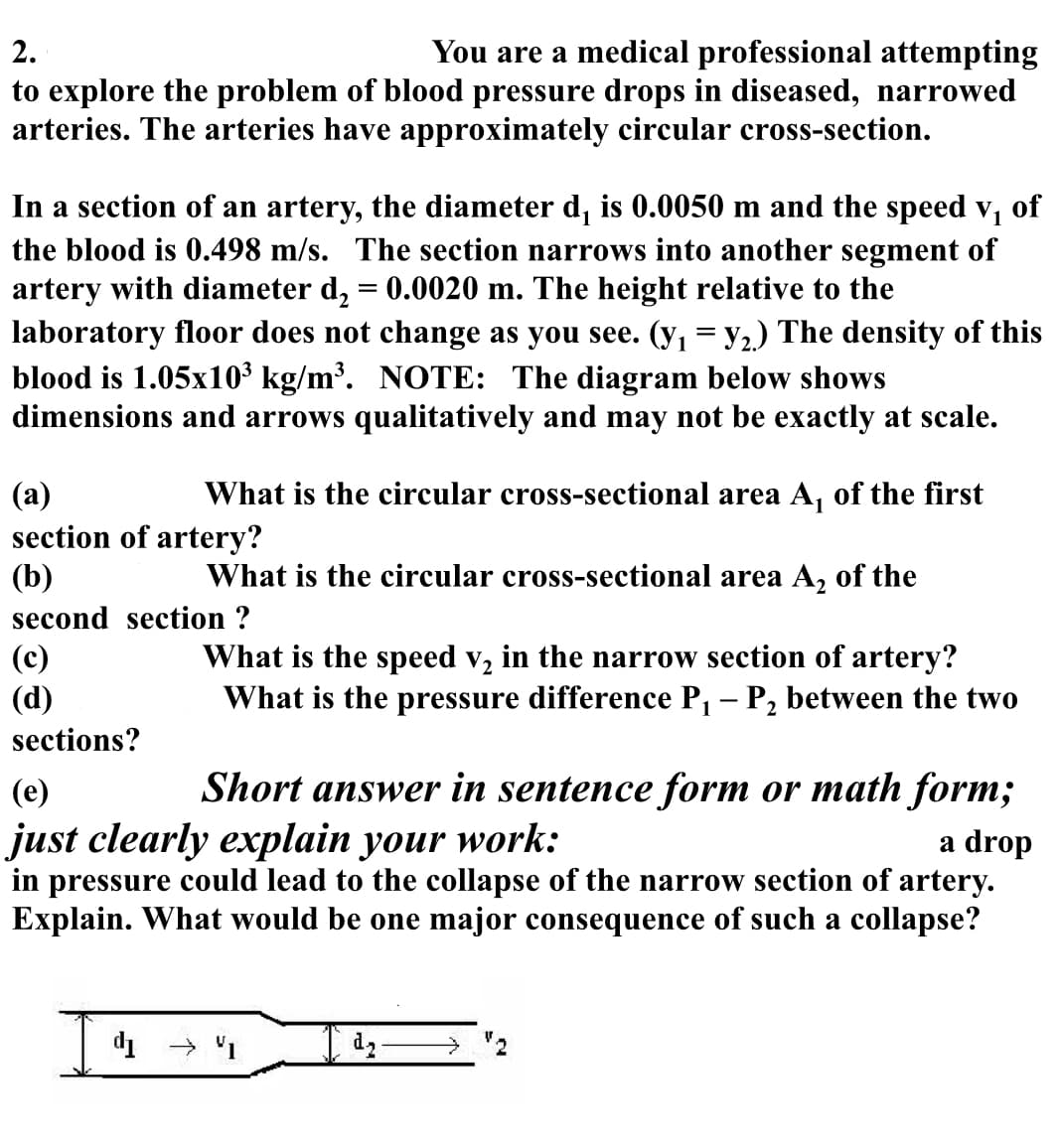 2.
You are a medical professional attempting
to explore the problem of blood pressure drops in diseased, narrowed
arteries. The arteries have approximately circular cross-section.
In a section of an artery, the diameter d, is 0.0050 m and the speed v₁ of
the blood is 0.498 m/s. The section narrows into another segment of
artery with diameter d₂ = 0.0020 m. The height relative to the
laboratory floor does not change as you see. (y₁ = y₂.) The density of this
blood is 1.05x10³ kg/m³. NOTE: The diagram below shows
dimensions and arrows qualitatively and may not be exactly at scale.
(a)
section of artery?
(b)
second section ?
What is the circular cross-sectional area A₁ of the first
(c)
(d)
sections?
What is the circular cross-sectional area A₂ of the
What is the speed v₂ in the narrow section of artery?
What is the pressure difference P₁ - P₂ between the two
1
2
(e)
Short answer in sentence form or math form;
just clearly explain your work:
a drop
in pressure could lead to the collapse of the narrow section of artery.
Explain. What would be one major consequence of such a collapse?
d₁ → 1
d₂