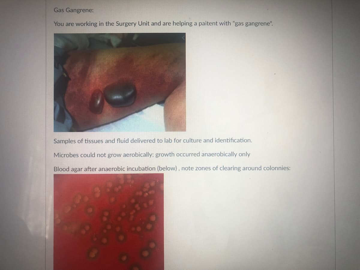 Gas Gangrene:
You are working in the Surgery Unit and are helping a paitent with "gas gangrene".
Samples of tissues and fluid delivered to lab for culture and identification.
Microbes could not grow aerobically; growth occurred anaerobically only
Blood agar after anaerobic incubation (below), note zones of clearing around colonnies:
