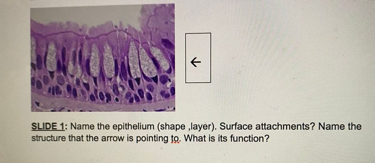 110
←
SLIDE 1: Name the epithelium (shape ,layer). Surface attachments? Name the
structure that the arrow is pointing to. What is its function?