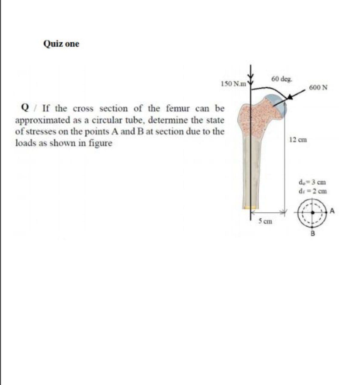 Q/ If the cross section of the femur can be
approximated as a circular tube, determine the state
of stresses on the points A and B at section due to the
loads as shown in figure
