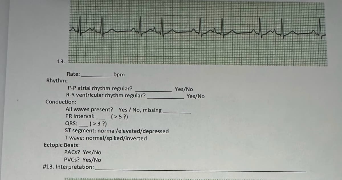 13.
السلس البرلس السالية البر البلد
bpm
P-P atrial rhythm regular?
R-R ventricular rhythm regular?
Rate:
Rhythm:
Conduction:
All waves present? Yes / No, missing.
PR interval:
(>5?)
QRS: _____ ( > 3 ?)
ST segment: normal/elevated/depressed
Twave: normal/spiked/inverted
Ectopic Beats:
PACs? Yes/No
PVCs? Yes/No
#13. Interpretation:
5035851
Yes/No
Yes/No