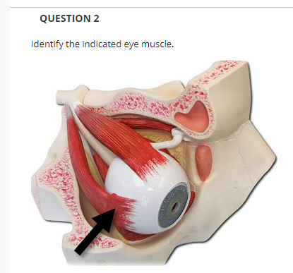QUESTION 2
Identify the indicated eye muscle.
