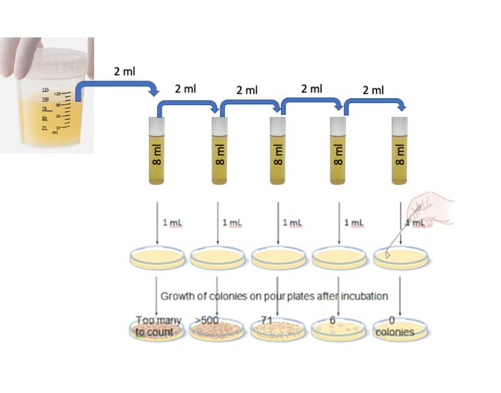 2 ml
2 ml
2 ml
2 ml
2 ml
1 ml
|1 ml
1 ml
1 ml
mL
Growth of colonies on pour plates after incubation
Too many 5od
to count
colonies
自
ju 8
8 ml
8 ml
8 ml
8 ml
