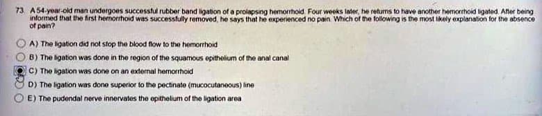 73 A 54-year-old man undergoes successful rubber band ligation of a prolapsing hemorrhoid Four weeks later, he returns to have another hemorrhoid ligated. After being
informed that the first hemorrhoid was successfully removed, he says that he experienced no pain. Which of the following is the most likely explanation for the absence
of pain?
A) The ligation did not stop the blood flow to the hemorrhoid
B) The ligation was done in the region of the squamous epithelium of the anal canal
C) The ligation was done on an external hemorrhoid
D) The ligation was done superior to the pectinate (mucocutaneous) line
E) The pudendal nerve innervates the epithelium of the ligation area