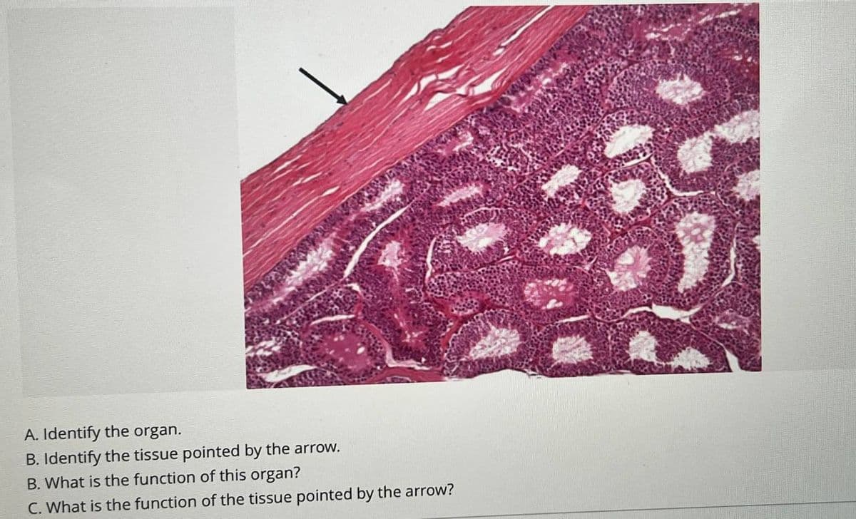A. Identify the organ.
B. Identify the tissue pointed by the arrow.
B. What is the function of this organ?
C. What is the function of the tissue pointed by the arrow?