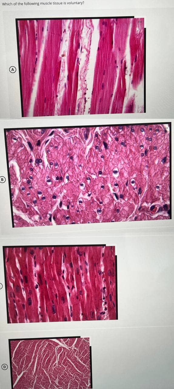 Which of the following muscle tissue is voluntary?