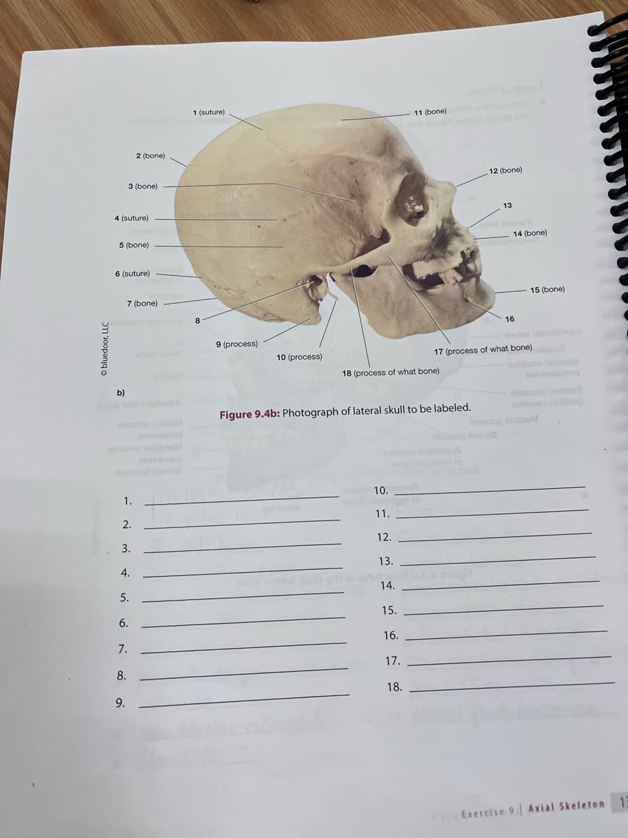 Ⓒbluedoor, LLC
4 (suture)
3 (bone)
5 (bone)
b)
6 (suture)
1.
7 (bone)
2.
2 (bone)
3.
4.
5.
9.
6.
7.
8.
anod IceH
808000010
1 (suture)
8
9 (process)
10 (process)
11 (bone) metal artido
18 (process of what bone)
Figure 9.4b: Photograph of lateral skull to be labeled.
10.
11.
12.
13.
Juola grit to astupa in
14.
15.
16.
17.
18.
12 (bone)
saboong bole
stored
13
17 (process of what bone)
14 (bone)
15 (bone)
16
outua leblobdmal
ollauoce temats3
autsem (yollbuq)
blotbel
Exercise 9 Axial Skeleton 13