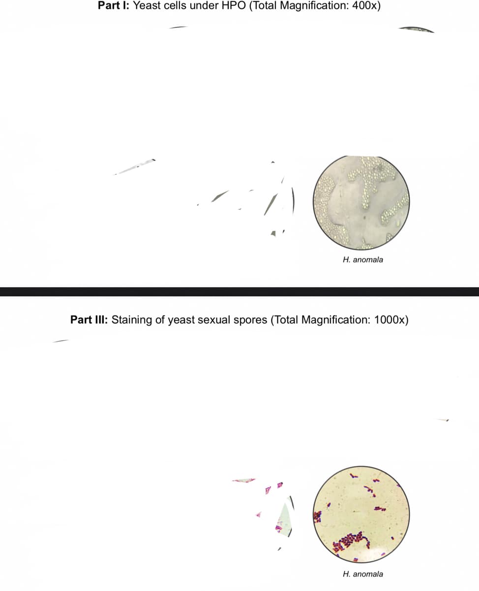 Part I: Yeast cells under HPO (Total Magnification: 400x)
ī
Saetril
H. anomala
Part III: Staining of yeast sexual spores (Total Magnification: 1000x)
H. anomala