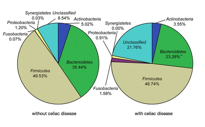 Synergistetes Unclassified
0.03%
Proteobacteria
1.20%
Fusobacteria
0.07%
Firmicutes
49.53%
8.54% Actinobacteria
5.02%
Bacteroidetes
35.44%
without celiac disease
Synergistetes
0.00%
Proteobacteria
0.91%
Fusobacteria
1.58%
Unclassified
21.76%
-Actinobacteria
3.55%
Bacteroidetes
23.28%*
Firmicutes
48.74%
with celiac disease