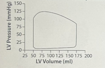 LV Pressure (mmHg)
150-
125
100-
75-
50-
25-
0+
25 50 75 100 125 150 175 200
LV Volume (ml)