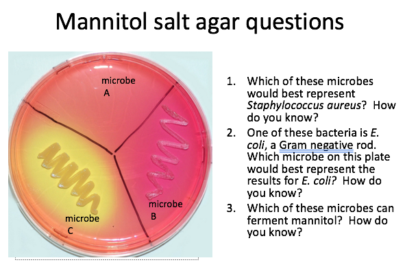 Mannitol salt agar questions
www
microbe
с
microbe
A
microbe
B
1. Which of these microbes
would best represent
Staphylococcus aureus? How
do you know?
2. One of these bacteria is E.
coli, a Gram negative rod.
Which microbe on this plate
would best represent the
results for E. coli? How do
you know?
3. Which of these microbes can
ferment mannitol? How do
you know?